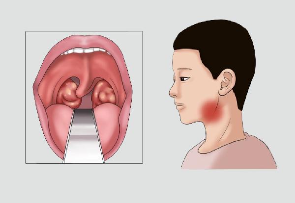 盘点日子中虚伪宣扬的食物？不要被零增加或纯天然误导！